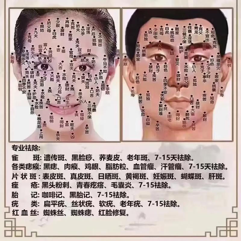 算命瘊子长哪有财运 瘊子命运图