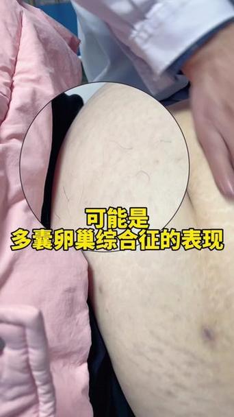 肚脐下有一根毛算命 肚子有毛玄学